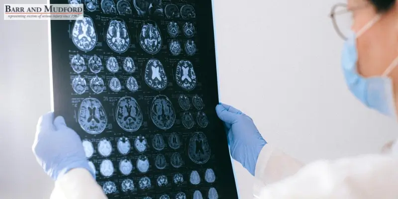 Skilled Red Bluff Traumatic Brain Injury Attorney