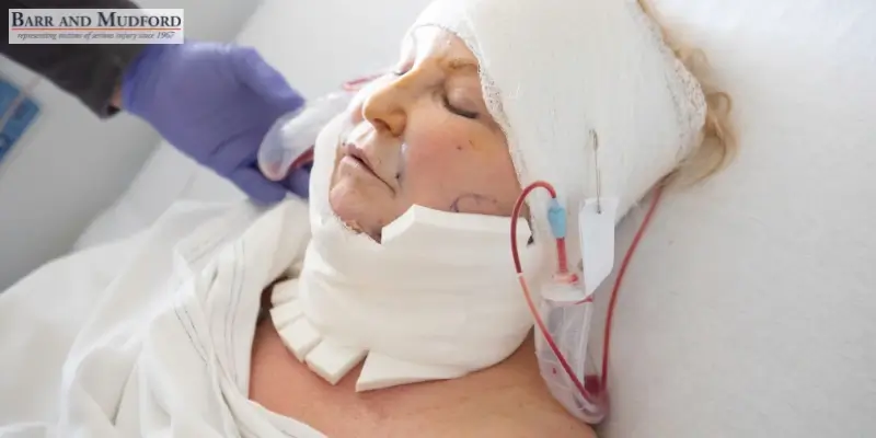 Dedicated Red Bluff Traumatic Brain Injury Lawyer